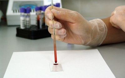 blood, sample, lab-17305.jpg